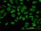 TUBA6 Antibody (monoclonal) (M04)